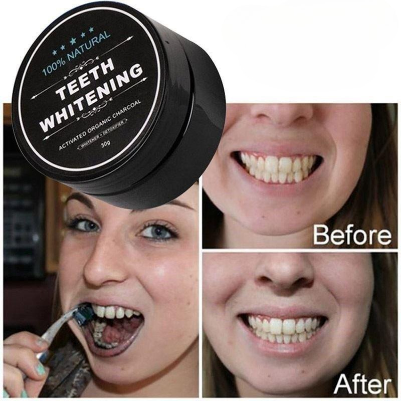 1 Box Activated Charcoal Teeth - огляд і ціна Teeth Whitening Pens